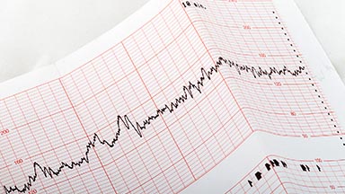 Department of Cardiovascular and Thoracic Surgery