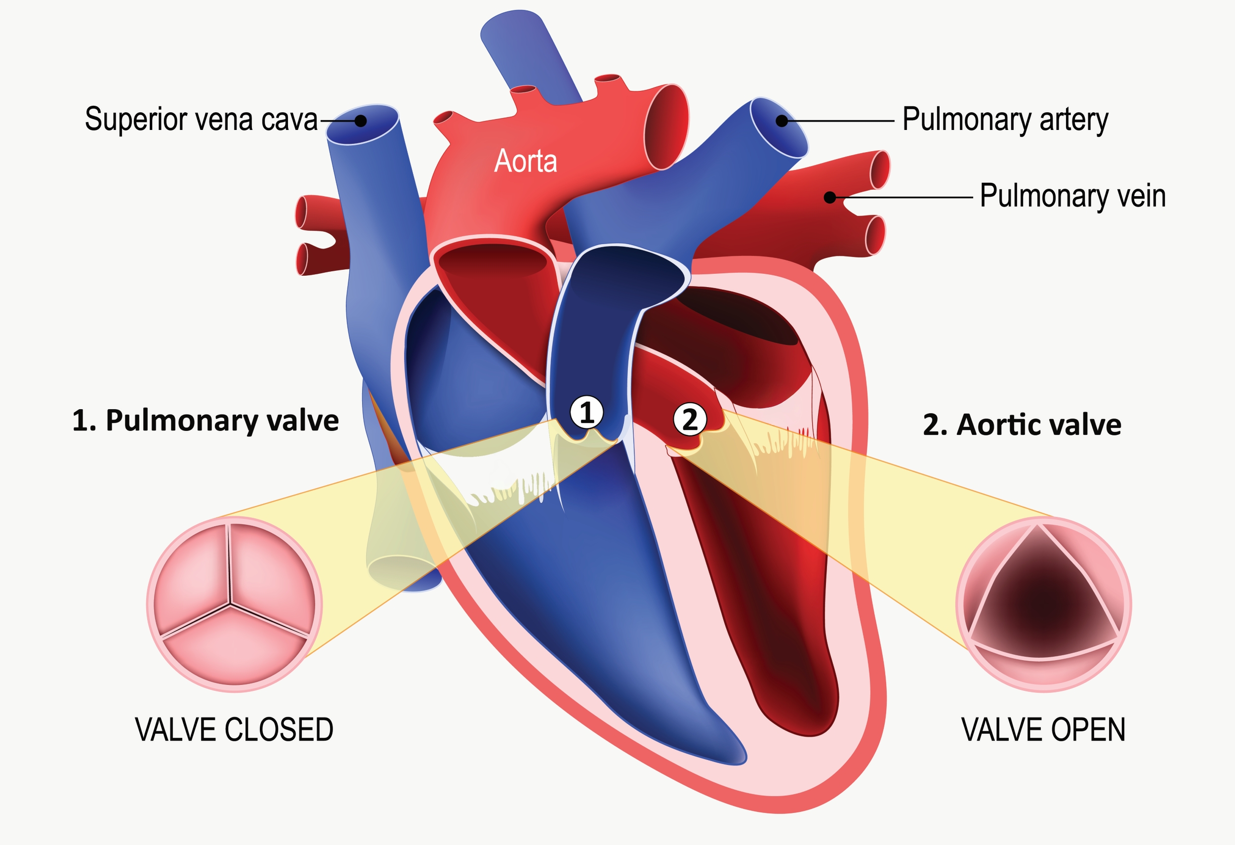 Ross procedure: Is this advanced aortic valve replacement right for you?