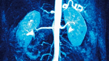 A medical scan highlighting kidneys and vascular structures in blue tones.