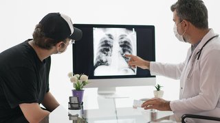 Lung cancer in young nonsmokers is on the rise: Uncovering the cause - Featured image