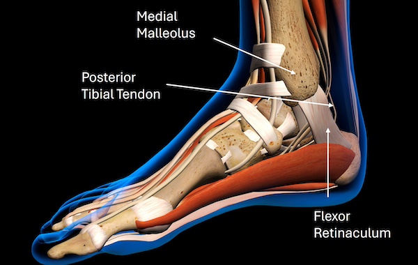 The ‘rare’ Porzingis ankle injury: What is it and how is it treated?
