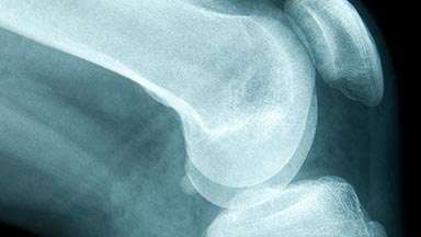 Department of Orthopaedic Surgery