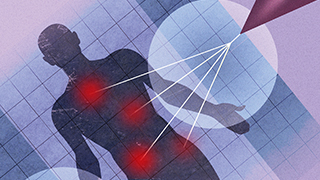 diagram of radiation treating a person's body