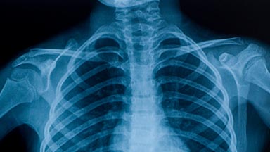 Department of Radiology