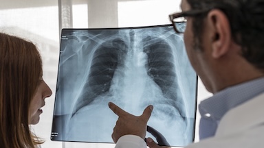 Doctors look at chest x-ray