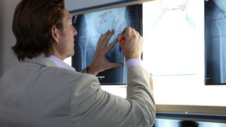 The hips don't lie: Signs it's time to consider hip replacement - Featured image