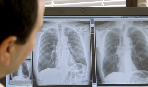 Lung transplant team provides relief for patients post-COVID-19